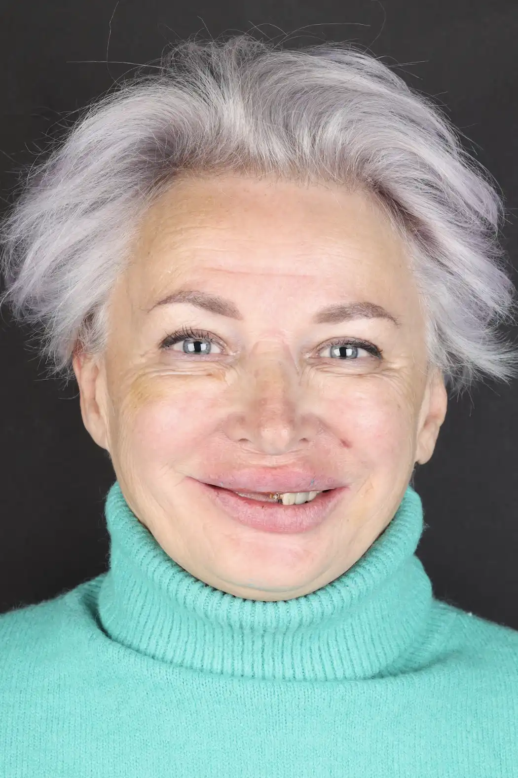 До лечения